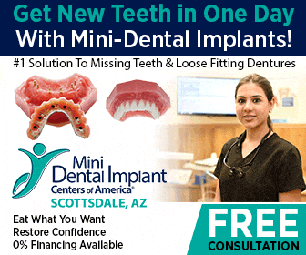 Mini Implantes Dentales en Scottsdale, AZ | Reemplazar los dientes perdidos en un día