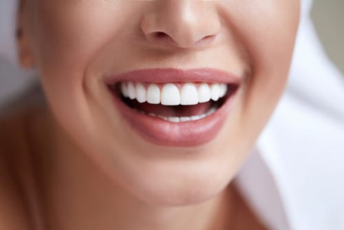Teeth Whitening in Scottsdale, AZ Mini Dental Implant Centers of America