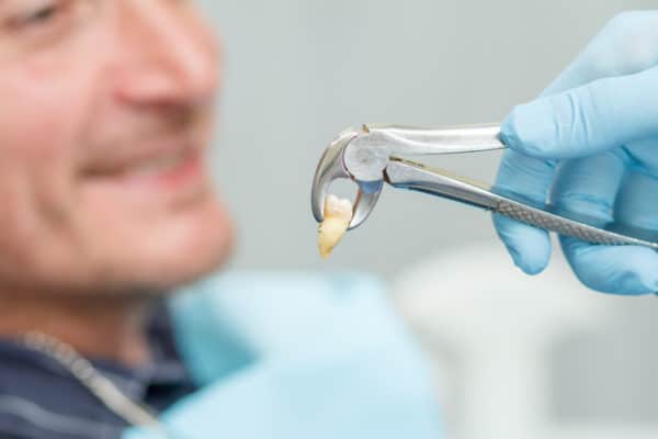 Tooth Extraction in Scottsdale, AZ Tooth Removal Dentist