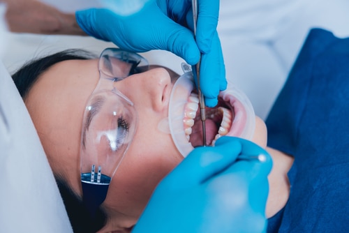 Endodoncia Preguntas Frecuentes Dentista Scottsdale Exámenes Gratuitos