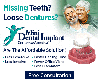 Mini Implantes Dentales en Scottsdale, AZ