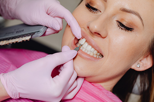 Veneer Dentist in Scottsdale, AZ | Smile Makeover | Dr. Mann